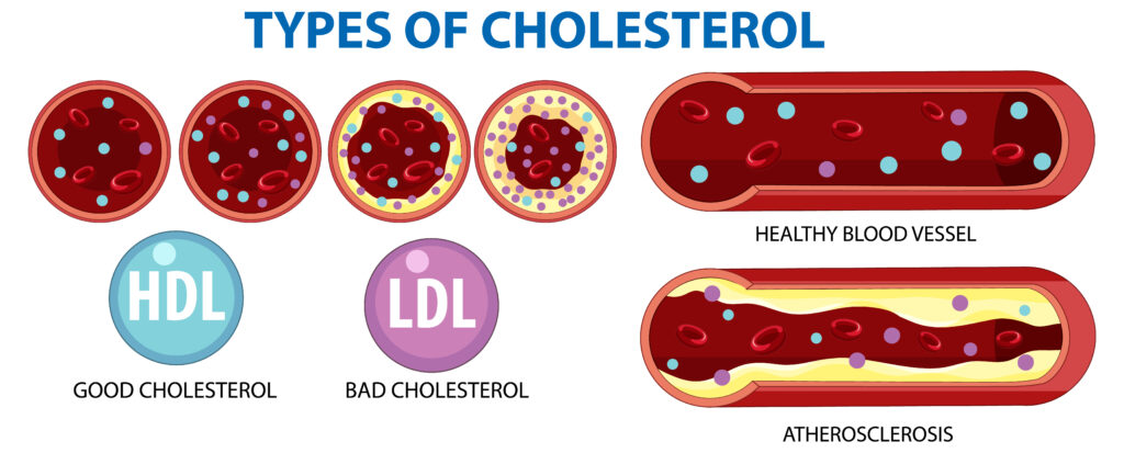 कोलेस्ट्रॉल क्या है