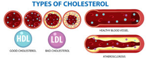 कोलेस्ट्रॉल क्या है